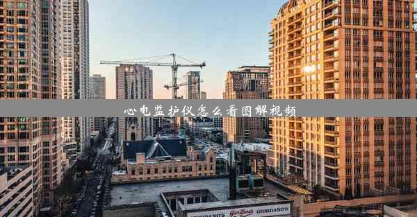 心电监护仪怎么看图解视频