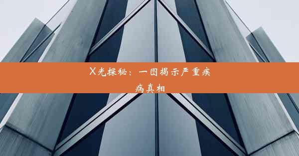 X光探秘：一图揭示严重疾病真相