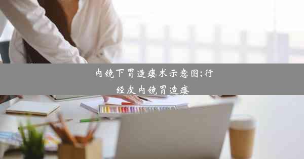 内镜下胃造瘘术示意图;行经皮内镜胃造瘘