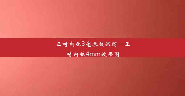 正畸内收3毫米效果图—正畸内收4mm效果图